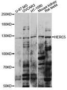 CEB1 / HERC5 Antibody - Western blot analysis of extracts of various cell lines, using HERC5 antibody at 1:1000 dilution. The secondary antibody used was an HRP Goat Anti-Rabbit IgG (H+L) at 1:10000 dilution. Lysates were loaded 25ug per lane and 3% nonfat dry milk in TBST was used for blocking. An ECL Kit was used for detection and the exposure time was 30s.