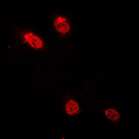 CEBPD + CEBPE Antibody - Immunofluorescent analysis of C/EBP delta/epsilon staining in HepG2 cells. Formalin-fixed cells were permeabilized with 0.1% Triton X-100 in TBS for 5-10 minutes and blocked with 3% BSA-PBS for 30 minutes at room temperature. Cells were probed with the primary antibody in 3% BSA-PBS and incubated overnight at 4 C in a humidified chamber. Cells were washed with PBST and incubated with a DyLight 594-conjugated secondary antibody (red) in PBS at room temperature in the dark. DAPI was used to stain the cell nuclei (blue).