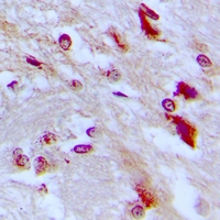 CEBPD + CEBPE Antibody - Immunohistochemical analysis of C/EBP epsilon (pT74) staining in human brain formalin fixed paraffin embedded tissue section. The section was pre-treated using heat mediated antigen retrieval with sodium citrate buffer (pH 6.0). The section was then incubated with the antibody at room temperature and detected using an HRP conjugated compact polymer system. DAB was used as the chromogen. The section was then counterstained with haematoxylin and mounted with DPX.