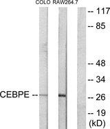 CEBPD + CEBPE Antibody - Western blot analysis of extracts from LOVO cells and RAW264.7 cells, using CEBPE antibody.