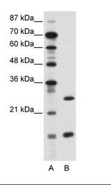 CEBPG / CEBP Gamma Antibody - A: Marker, B: Jurkat Cell Lysate.  This image was taken for the unconjugated form of this product. Other forms have not been tested.