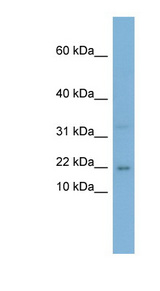 CEBPG / CEBP Gamma Antibody - CEBPG / CEBP Gamma antibody Western blot of PANC1 cell lysate. This image was taken for the unconjugated form of this product. Other forms have not been tested.