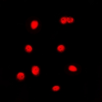 CEBPG / CEBP Gamma Antibody - Immunofluorescent analysis of C/EBP gamma staining in Jurkat cells. Formalin-fixed cells were permeabilized with 0.1% Triton X-100 in TBS for 5-10 minutes and blocked with 3% BSA-PBS for 30 minutes at room temperature. Cells were probed with the primary antibody in 3% BSA-PBS and incubated overnight at 4 deg C in a humidified chamber. Cells were washed with PBST and incubated with a DyLight 594-conjugated secondary antibody (red) in PBS at room temperature in the dark. DAPI was used to stain the cell nuclei (blue).
