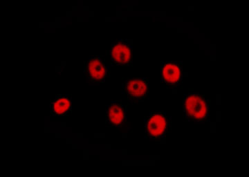 CEBPG / CEBP Gamma Antibody - Staining RAW264.7 cells by IF/ICC. The samples were fixed with PFA and permeabilized in 0.1% Triton X-100, then blocked in 10% serum for 45 min at 25°C. The primary antibody was diluted at 1:200 and incubated with the sample for 1 hour at 37°C. An Alexa Fluor 594 conjugated goat anti-rabbit IgG (H+L) antibody, diluted at 1/600, was used as secondary antibody.