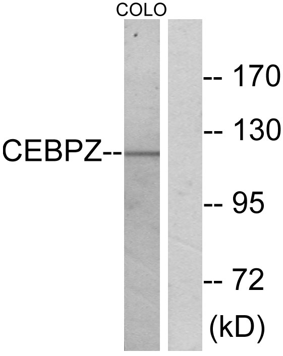 CEBPZ / CBF Antibody - Western blot analysis of lysates from COLO cells, using CEBPZ Antibody. The lane on the right is blocked with the synthesized peptide.