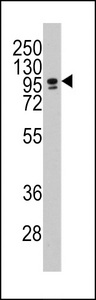 CEBPZ / CBF Antibody - Western blot of anti-CEBPZ Antibody in NCI-H460 cell line lysates (35 ug/lane). CEBPZ(arrow) was detected using the purified antibody.
