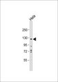 CEBPZ / CBF Antibody - Anti-C/EBP zeta Antibody at 1:1000 dilution + HeLa whole cell lysate Lysates/proteins at 20 ug per lane. Secondary Goat Anti-Rabbit IgG, (H+L), Peroxidase conjugated at 1:10000 dilution. Predicted band size: 121 kDa. Blocking/Dilution buffer: 5% NFDM/TBST.