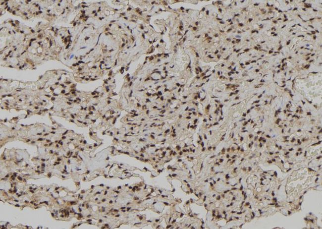 CEBPZ / CBF Antibody - 1:100 staining human lung tissue by IHC-P. The sample was formaldehyde fixed and a heat mediated antigen retrieval step in citrate buffer was performed. The sample was then blocked and incubated with the antibody for 1.5 hours at 22°C. An HRP conjugated goat anti-rabbit antibody was used as the secondary.