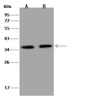 CEBPZ / CBF Antibody - Anti-CEBPZ rabbit polyclonal antibody at 1:500 dilution. Lane A: HeLa Whole Cell Lysate. Lane B: U-251 MG Whole Cell Lysate. Lysates/proteins at 30 ug per lane. Secondary: Goat Anti-Rabbit IgG (H+L)/HRP at 1/10000 dilution. Developed using the ECL technique. Performed under reducing conditions. Predicted band size: 19 kDa. Observed band size: 35 kDa.