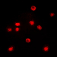CEBPZ / CBF Antibody - Immunofluorescent analysis of C/EBP zeta staining in COLO205 cells. Formalin-fixed cells were permeabilized with 0.1% Triton X-100 in TBS for 5-10 minutes and blocked with 3% BSA-PBS for 30 minutes at room temperature. Cells were probed with the primary antibody in 3% BSA-PBS and incubated overnight at 4 deg C in a humidified chamber. Cells were washed with PBST and incubated with a DyLight 594-conjugated secondary antibody (red) in PBS at room temperature in the dark. DAPI was used to stain the cell nuclei (blue).