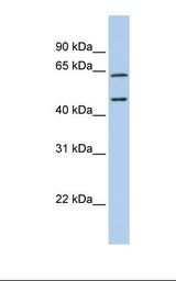 CECR1 Antibody - Fetal brain lysate. Antibody concentration: 1.0 ug/ml. Gel concentration: 12%.  This image was taken for the unconjugated form of this product. Other forms have not been tested.
