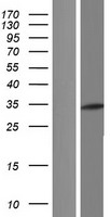 CECR1 Protein - Western validation with an anti-DDK antibody * L: Control HEK293 lysate R: Over-expression lysate