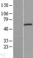CECR1 Protein - Western validation with an anti-DDK antibody * L: Control HEK293 lysate R: Over-expression lysate
