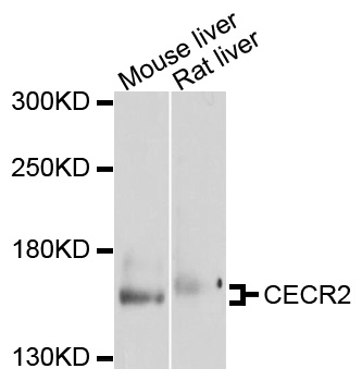CECR2 Antibody - Western blot analysis of extracts of various cell lines, using CECR2 antibody at 1:1000 dilution. The secondary antibody used was an HRP Goat Anti-Rabbit IgG (H+L) at 1:10000 dilution. Lysates were loaded 25ug per lane and 3% nonfat dry milk in TBST was used for blocking. An ECL Kit was used for detection and the exposure time was 60s.