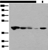 CECR5 Antibody - Western blot analysis of Jurkat HEPG2 and Hela cell Human testis tissue 231 cell lysates  using CECR5 Polyclonal Antibody at dilution of 1:650