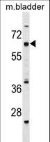 CECR6 Antibody - CECR6 Antibody western blot of mouse bladder tissue lysates (35 ug/lane). The CECR6 antibody detected the CECR6 protein (arrow).