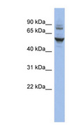 CECR6 Antibody - CECR6 antibody Western blot of HT1080 cell lysate. This image was taken for the unconjugated form of this product. Other forms have not been tested.