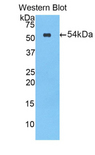 CEL / Carboxyl Ester Lipase Antibody - Western blot of recombinant CEL / Carboxyl Ester Lipase.  This image was taken for the unconjugated form of this product. Other forms have not been tested.