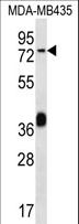 CEL / Carboxyl Ester Lipase Antibody - CEL Antibody western blot of MDA-MB435 cell line lysates (35 ug/lane). The CEL antibody detected the CEL protein (arrow).