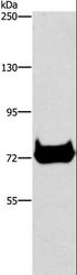CEL / Carboxyl Ester Lipase Antibody - Western blot analysis of Mouse pancreas tissue, using CEL Polyclonal Antibody at dilution of 1:500.