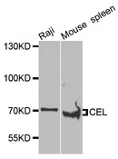 CEL / Carboxyl Ester Lipase Antibody - Western blot analysis of extracts of various cells.