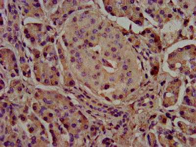 CEL / Carboxyl Ester Lipase Antibody - Immunohistochemistry image at a dilution of 1:500 and staining in paraffin-embedded human pancreatic tissue performed on a Leica BondTM system. After dewaxing and hydration, antigen retrieval was mediated by high pressure in a citrate buffer (pH 6.0) . Section was blocked with 10% normal goat serum 30min at RT. Then primary antibody (1% BSA) was incubated at 4 °C overnight. The primary is detected by a biotinylated secondary antibody and visualized using an HRP conjugated SP system.