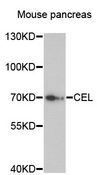 CEL / Carboxyl Ester Lipase Antibody - Western blot analysis of extracts of mouse pancreas, using CEL antibody at 1:3000 dilution. The secondary antibody used was an HRP Goat Anti-Rabbit IgG (H+L) at 1:10000 dilution. Lysates were loaded 25ug per lane and 3% nonfat dry milk in TBST was used for blocking. An ECL Kit was used for detection and the exposure time was 90s.