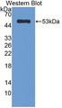 CELA1 / Pancreatic Elastase 1 Antibody - Western blot of CELA1 / Pancreatic Elastase 1 antibody.