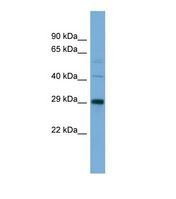 CELA2A / ELA2A Antibody - Western blot of Human 721_B. ELA2A antibody dilution 1.0 ug/ml.  This image was taken for the unconjugated form of this product. Other forms have not been tested.