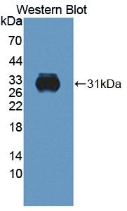 CELA2A / ELA2A Antibody - Western blot of CELA2A / ELA2A antibody.