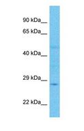 CELA2A / ELA2A Antibody - Western blot of CEL2A Antibody with human Large intestine Tumor lysate.  This image was taken for the unconjugated form of this product. Other forms have not been tested.