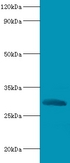 CELA2A / ELA2A Antibody - Western blot of Chymotrypsin-like elastase family member 2A antibody at 2 ug/ml with recombinant Chymotrypsin-like elastase family member 2A protein 0.1 ug Secondary Goat polyclonal to Rabbit lgG at 1:15000 dilution. Predicted band size: 29 KDa. Observed band size: 29 KDa.  This image was taken for the unconjugated form of this product. Other forms have not been tested.