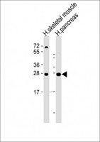 CELA2B / ELA2B Antibody - All lanes: Anti-CELA2B Antibody (Center) at 1:2000 dilution. Lane 1: human skeletal muscle lysate. Lane 2: human pancreas lysate Lysates/proteins at 20 ug per lane. Secondary Goat Anti-Rabbit IgG, (H+L), Peroxidase conjugated at 1:10000 dilution. Predicted band size: 29 kDa. Blocking/Dilution buffer: 5% NFDM/TBST.