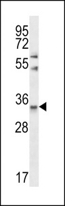 CELA3A / ELA3 Antibody - CELA3A Antibody western blot of Jurkat cell line lysates (35 ug/lane). The CELA3A antibody detected the CELA3A protein (arrow).