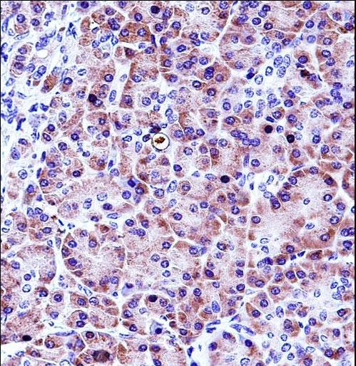 CELA3A / ELA3 Antibody - CELA3A Antibody immunohistochemistry of formalin-fixed and paraffin-embedded human pancreas tissue followed by peroxidase-conjugated secondary antibody and DAB staining.