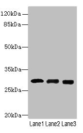 CELA3A / ELA3 Antibody - Western blot All lanes: Chymotrypsin-like elastase family member 3A antibody at 14µg/ml Lane 1: Mouse heart tissue Lane 2: Mouse skeletal muscle tissue Lane 3: Jurkat whole cell lysate Secondary Goat polyclonal to rabbit IgG at 1/10000 dilution Predicted band size: 29 kDa Observed band size: 29 kDa