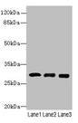CELA3A / ELA3 Antibody - Western blot All lanes: Chymotrypsin-like elastase family member 3A antibody at 14µg/ml Lane 1: Mouse heart tissue Lane 2: Mouse skeletal muscle tissue Lane 3: Jurkat whole cell lysate Secondary Goat polyclonal to rabbit IgG at 1/10000 dilution Predicted band size: 29 kDa Observed band size: 29 kDa