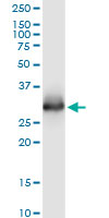 CELA3A / ELA3 Antibody - ELA3A monoclonal antibody (M02), clone 3G4. Western blot of ELA3A expression in human pancreas.