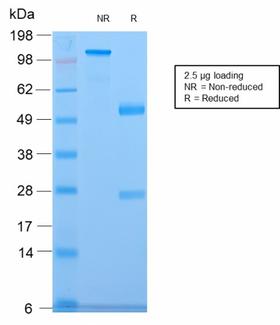 CELA3B / ELA3B Antibody - SDS-PAGE Analysis of Purified CELA3B Rabbit Recombinant Monoclonal Antibody (CELA3B/2809R). Confirmation of Purity and Integrity of Antibody.