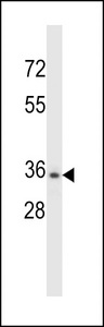 CELA3B / ELA3B Antibody - CELA3B Antibody western blot of NCI-H460 cell line lysates (35 ug/lane). The CELA3B antibody detected the CELA3B protein (arrow).