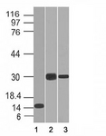 CELA3B / ELA3B Antibody - Western blot of 1) partial recombinant protein, 2) Panc-28 and 3) PANC1 cell lysate using CELA3B antibody (CELA3B/1218). Predicted molecular weight ~29 kDa.  This image was taken for the unmodified form of this product. Other forms have not been tested.