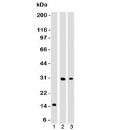 CELA3B / ELA3B Antibody - Western blot of 1) partial recombinant protein, 2) Panc-28 and 3) PANC1 cell lysate using CELA3B antibody (ELTS3B-1). Predicted molecular weight ~29 kDa.  This image was taken for the unmodified form of this product. Other forms have not been tested.