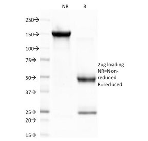 CELA3B / ELA3B Antibody - SDS-PAGE Analysis of Purified, BSA-Free CELA3B Antibody (clone CELA3B/1757). Confirmation of Integrity and Purity of the Antibody.