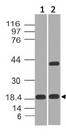 CELA3B / ELA3B Antibody - Fig-1: Expression analysis of CELA3B. Anti-CELA3B antibody was used at 2 µg/ml on (1) Recombinant and (2) SW1990 lysates.