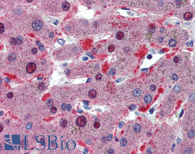 CELF1 / CUGBP1 Antibody - Anti-CELF1 / CUGBP1 antibody IHC of human liver. Immunohistochemistry of formalin-fixed, paraffin-embedded tissue after heat-induced antigen retrieval. Antibody concentration 5 ug/ml.  This image was taken for the unconjugated form of this product. Other forms have not been tested.