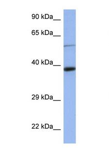 CELF1 / CUGBP1 Antibody - CELF1 / CUGBP1 antibody Western blot of 3 Cell lysate. Antibody concentration 1 ug/ml. This image was taken for the unconjugated form of this product. Other forms have not been tested.