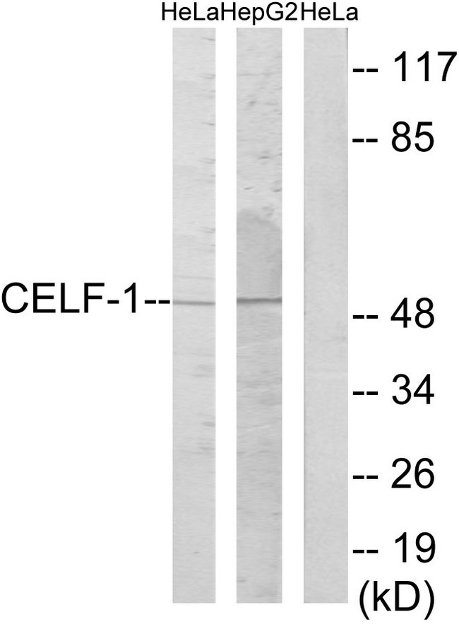 CELF1 / CUGBP1 Antibody - Western blot analysis of lysates from HeLa and HepG2 cells, using CELF-1 Antibody. The lane on the right is blocked with the synthesized peptide.