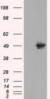 CELF1 / CUGBP1 Antibody - HEK293T cells were transfected with the pCMV6-ENTRY control (Left lane) or pCMV6-ENTRY CUGBP1 (Right lane) cDNA for 48 hrs and lysed. Equivalent amounts of cell lysates (5 ug per lane) were separated by SDS-PAGE and immunoblotted with anti-CUGBP1.