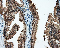 CELF1 / CUGBP1 Antibody - IHC of paraffin-embedded prostate tissue using anti-CUGBP1 mouse monoclonal antibody. (Dilution 1:50).