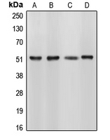 CELF1 / CUGBP1 Antibody - Western blot analysis of CUGBP1 expression in HL60 (A); HeLa (B); NIH3T3 (C); Sol8 (D) whole cell lysates.